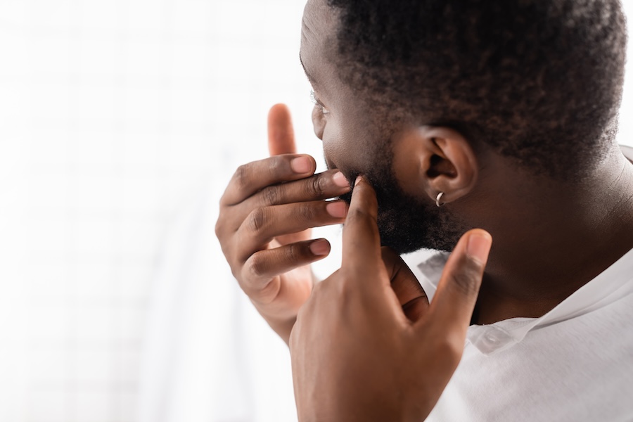 How to Prevent Beard Pimples: Skincare Tips for Bearded Men
