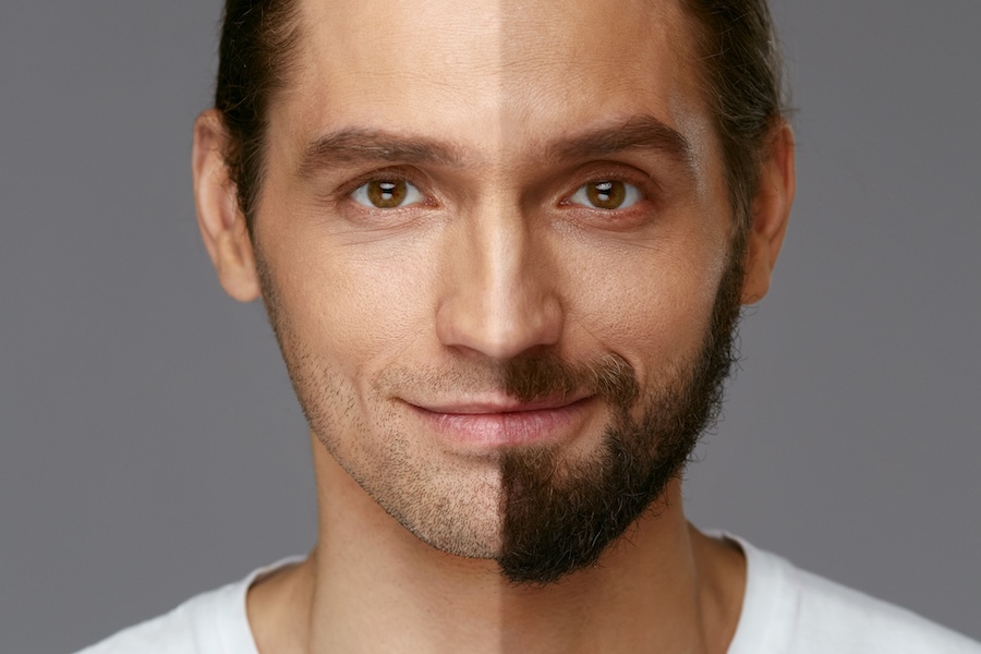 Is It Better to Grow a Beard or Stay Clean-Shaven?