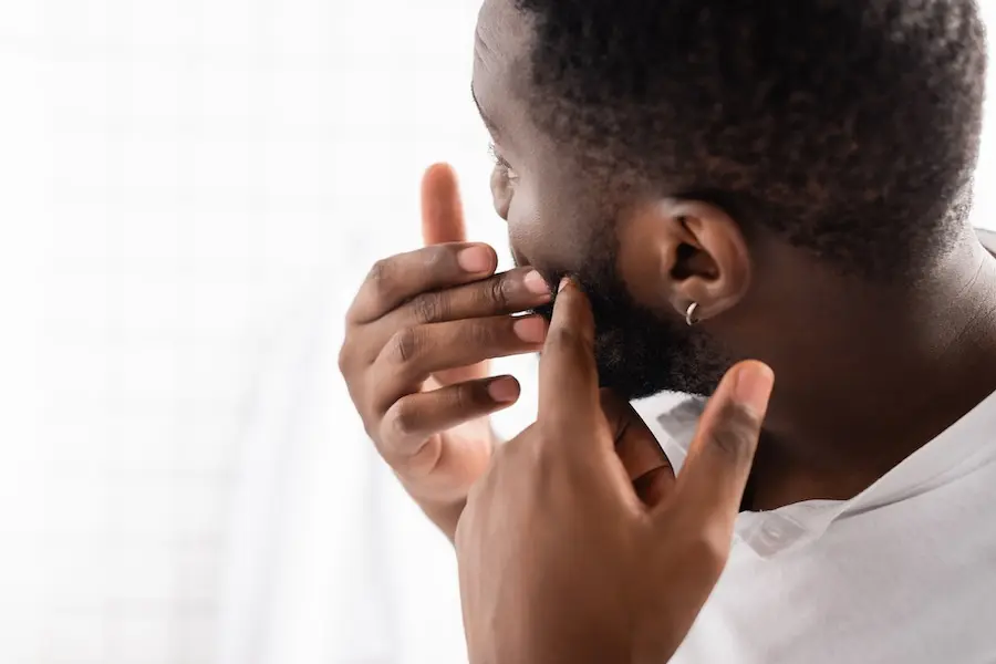 How to Prevent Beard Pimples: Skincare Tips for Bearded Men